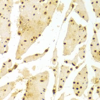 Polyclonal Rabbit anti-Human HIST2H2BE Antibody (IHC, WB)