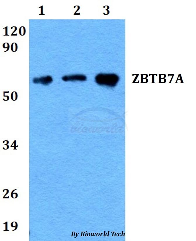 ZBTB7A / Pokemon Antibody