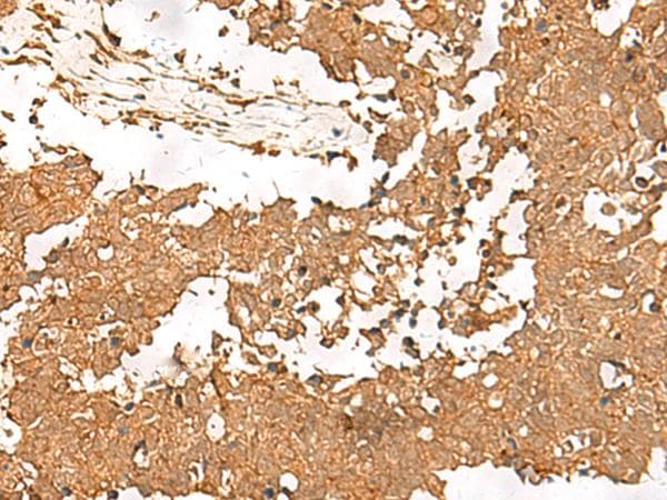 Polyclonal Rabbit anti-Human SMOC1 Antibody (IHC)