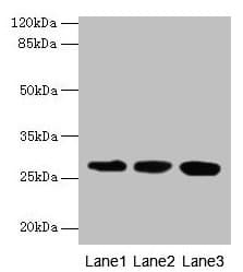 KHDC1 / C6orf148 Antibody