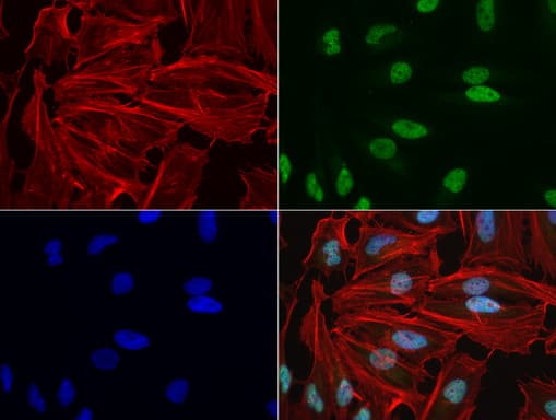 NBN / Nibrin Antibody (aa461-754, clone UMAB99)