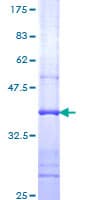 Human ATP6V1C1 Protein (Recombinant GST, N-terminus)