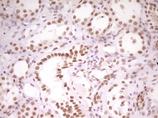 HMG20A Antibody (aa1-281, clone OTI2H4)