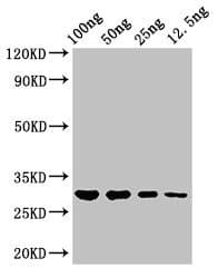 Polyclonal Rabbit anti-Salmonella typhi hupB Antibody (WB)