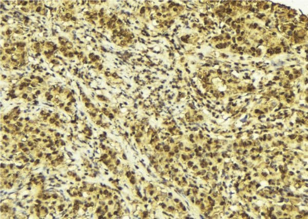 CRBN / Cereblon Antibody