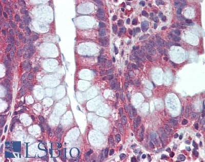 IHC-plus™ Polyclonal Rabbit anti-Human RIPK3 / RIP3 Antibody (aa400-450, IHC, WB)
