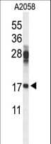 RPS11 / Ribosomal Protein 11 Antibody (aa80-108)