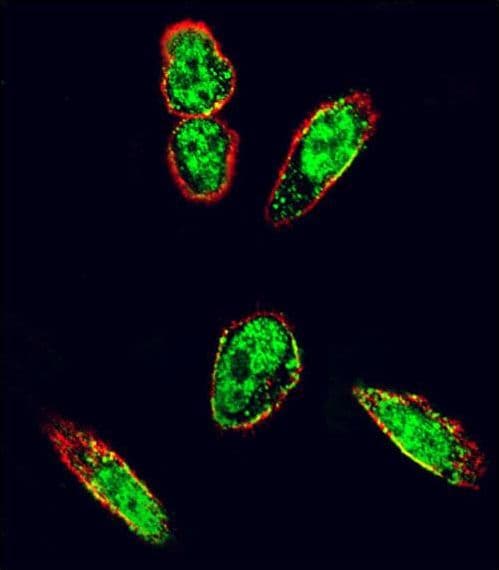 IHC-plus™ SRC Antibody (aa1-30)