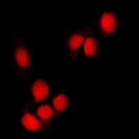 RNF2 / RING2 / RING1B Antibody