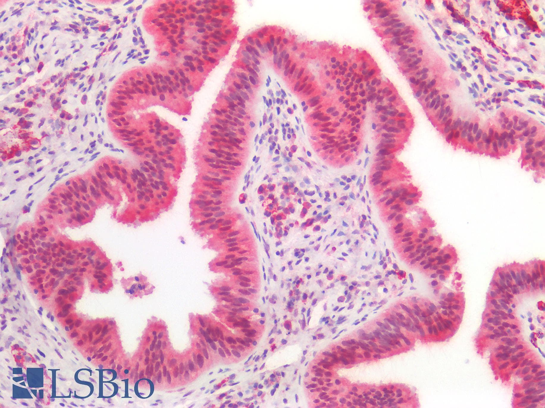PathPlus™ CCDC6 Antibody