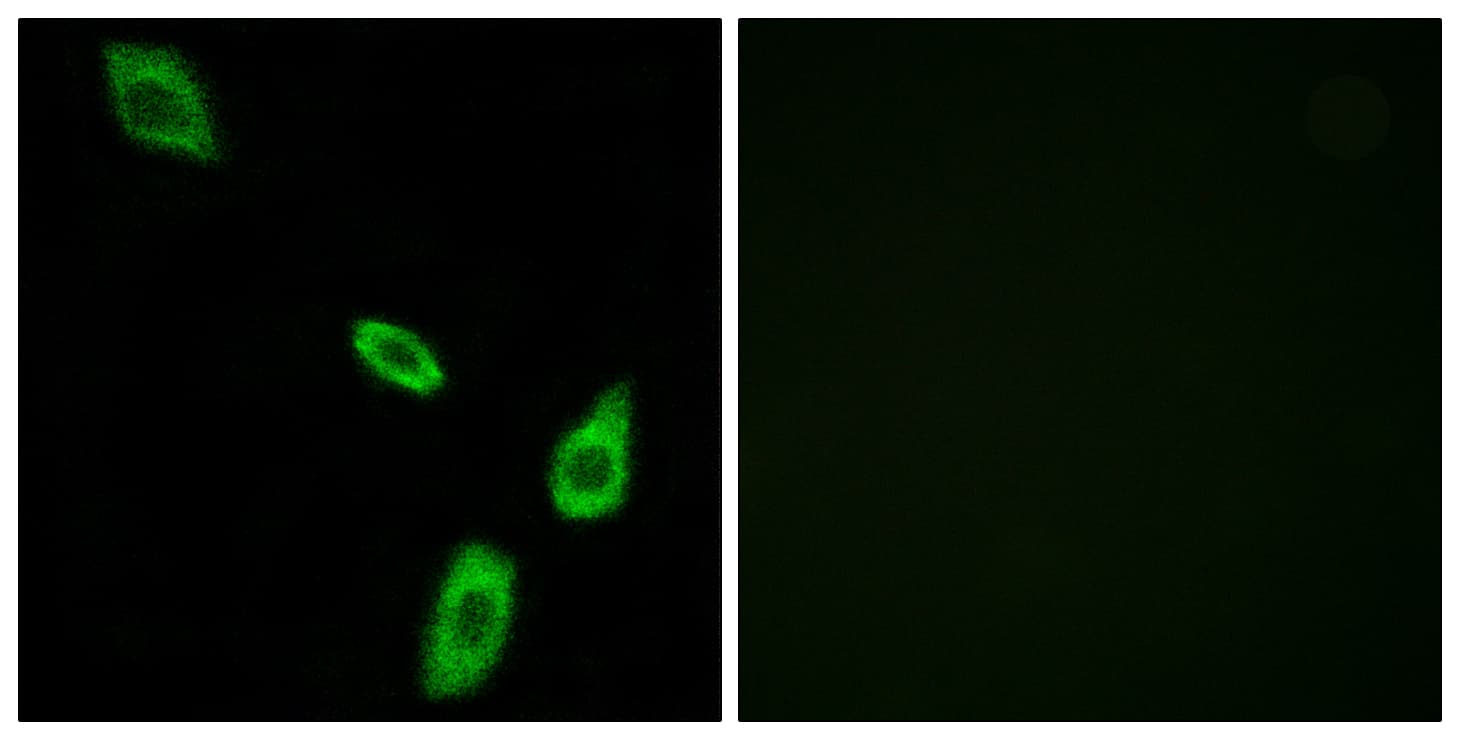 ADRA1B / Adrenoceptor alpha 1B Antibody (aa431-480)