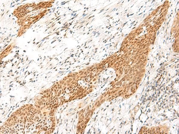 Polyclonal Rabbit anti-Human RPS27A Antibody (IHC)
