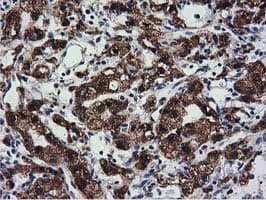CYB5R3 / B5R Antibody (clone OTI2A10)