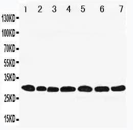PRDX4 / Peroxiredoxin 4 Antibody (aa253-271)
