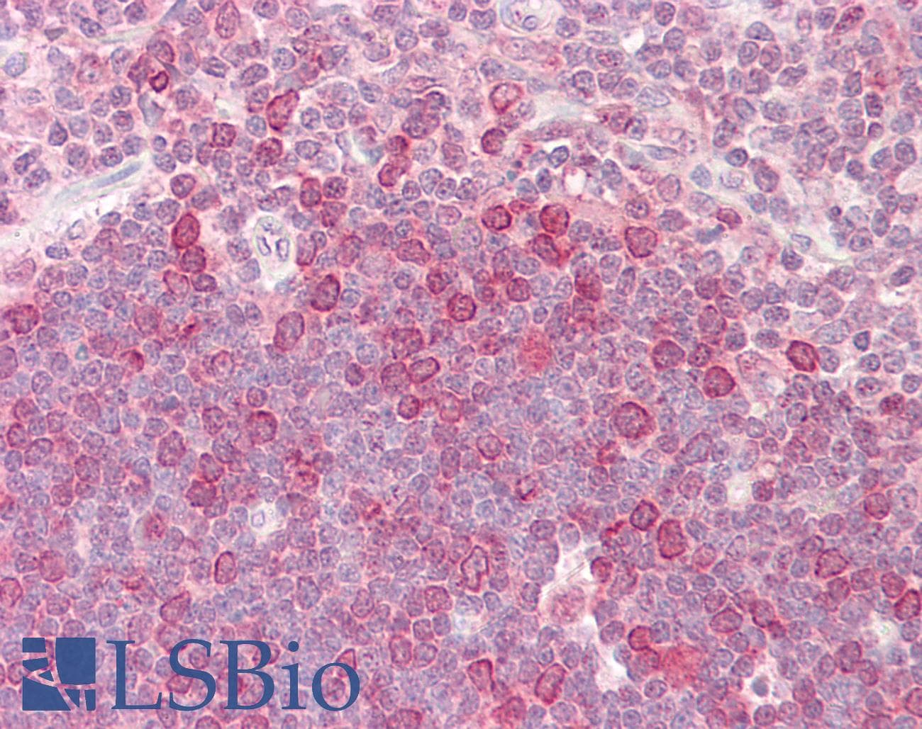 IHC-plus™ HELO1 / ELOVL5 Antibody (aa250-299)