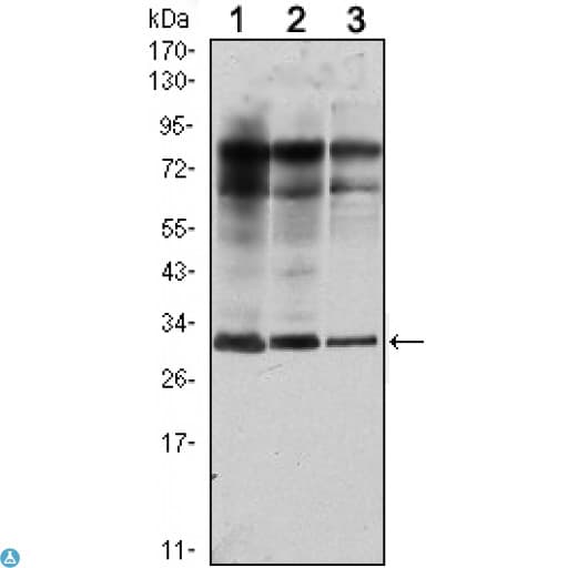 RAB25 Antibody