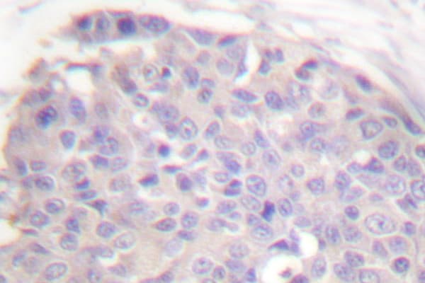 CARD6 Antibody (Ala2)