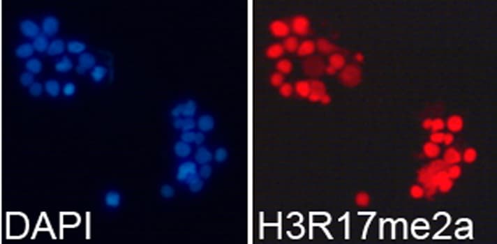 Histone H3 Antibody (Asym-Di-Methyl-Arg17)