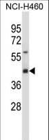 SYT1 / Synaptotagmin Antibody (aa349-377)