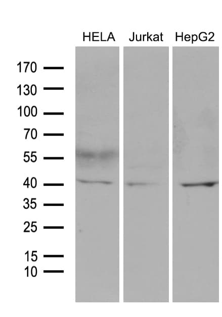 LSM11 Antibody (clone OTI2A11)