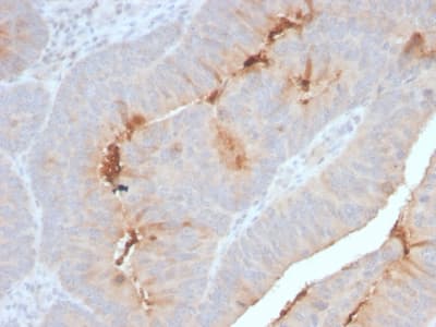 Recombinant Monoclonal Rabbit anti-Human SAA1 / SAA / Serum Amyloid A Antibody (clone SAA/2868R, IHC)