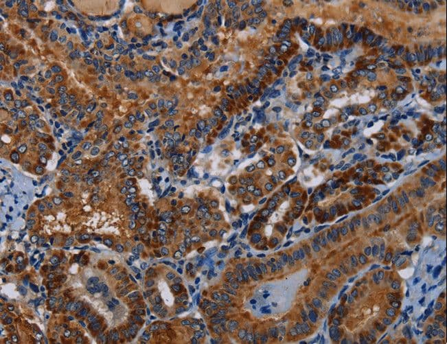 PIDD1 Antibody