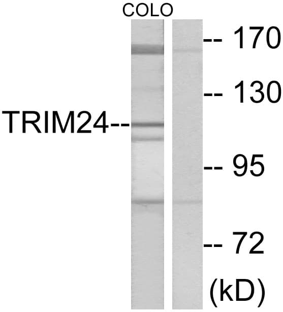 IHC-plus™ TRIM24 / TIF1 Antibody (aa1001-1050)
