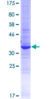 Human WFDC12 Protein (Recombinant GST)