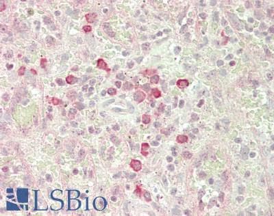 IHC-plus™ BST2 Antibody (Internal)