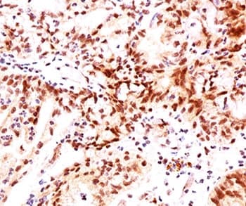 ESR2 / ER Beta Antibody (C-Terminus, clone ERb455, Ready-to-Use)