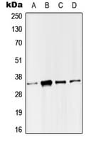 SMUG1 Antibody (Internal)
