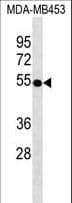 Vitamin D Receptor / VDR Antibody