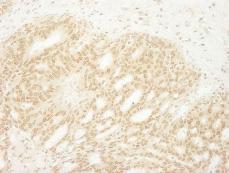 MKRN1 Antibody (aa432-C-term)