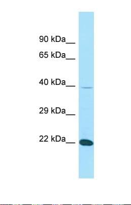 FIBP Antibody (aa99-148)