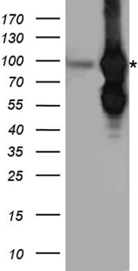 Polyclonal Rabbit anti-Human BRAF / B-Raf Antibody (WB)