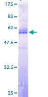 Human TGIF2 Protein (Recombinant GST)