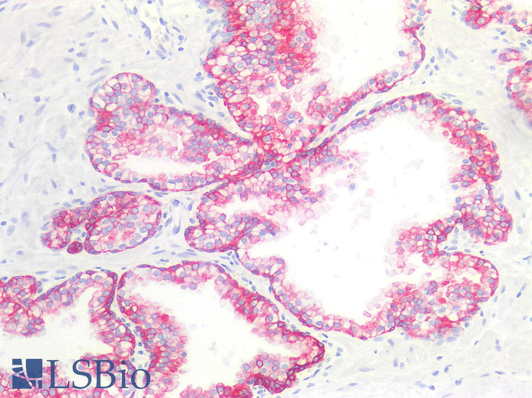 PathPlus™ KRT19 / CK19 / Cytokeratin 19 Antibody (clone A53-B/A2)