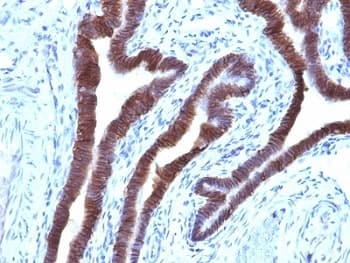 EPCAM Antibody (Cytoplasmic Domain, clone EGP40/1110, Ready-to-Use)