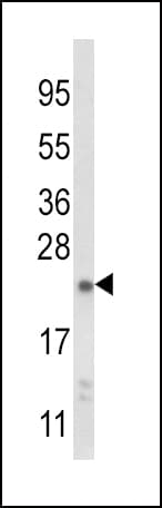 NQO2 Antibody (aa141-168)