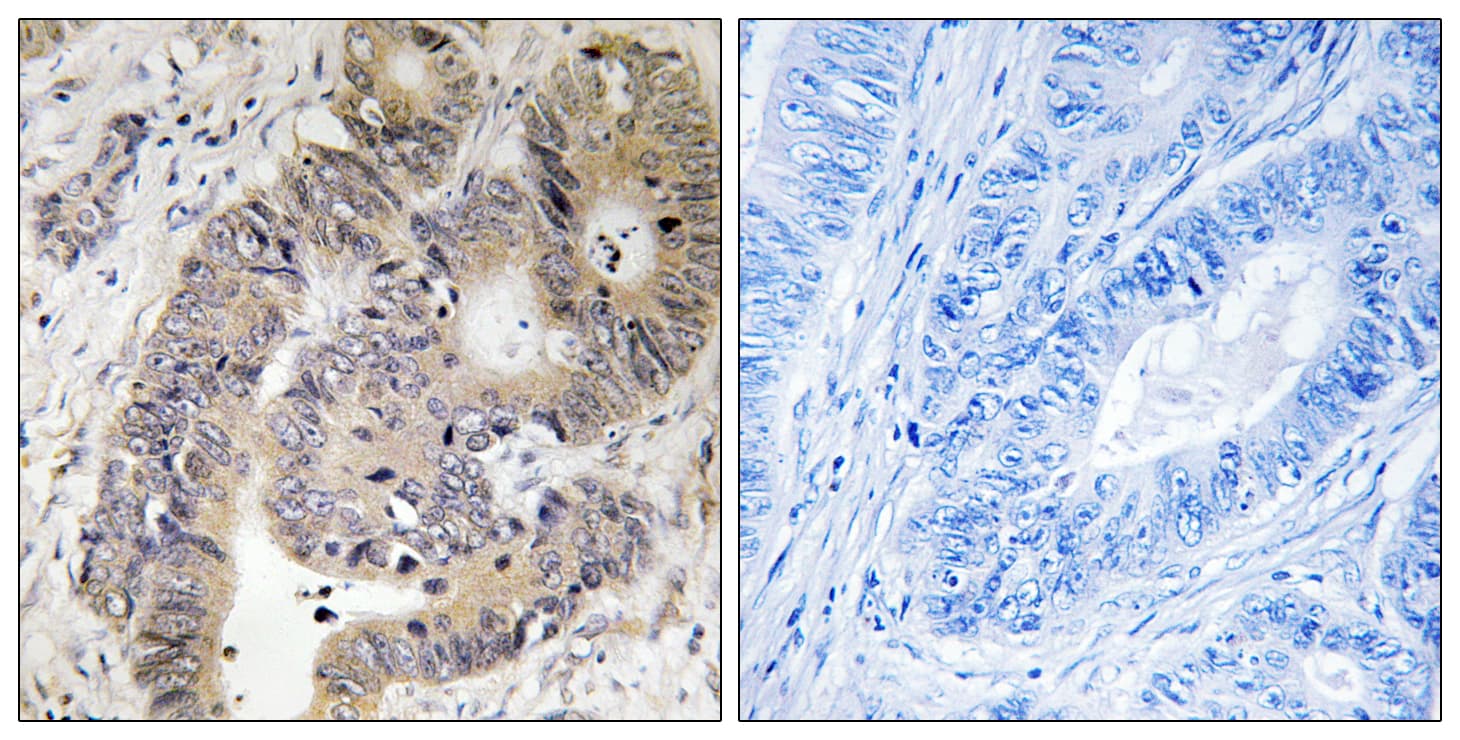 CAD Antibody (phospho-Thr456)