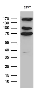 Monoclonal Mouse anti-Human CCDC22 Antibody (clone OTI2E4, Carrier-free, IHC, WB)