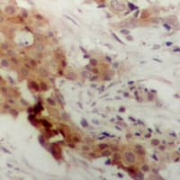 Polyclonal Rabbit anti-Human MAPKAPK2 / MAPKAP Kinase 2 Antibody (IHC, WB)