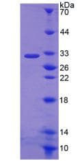 Rat NOX3 Protein (Recombinant His-T7)