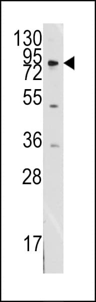 NEP / DDR1 Antibody