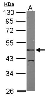 Polyclonal Rabbit anti-Human LDB1 / CLIM2 Antibody (aa86-411, IHC, WB)