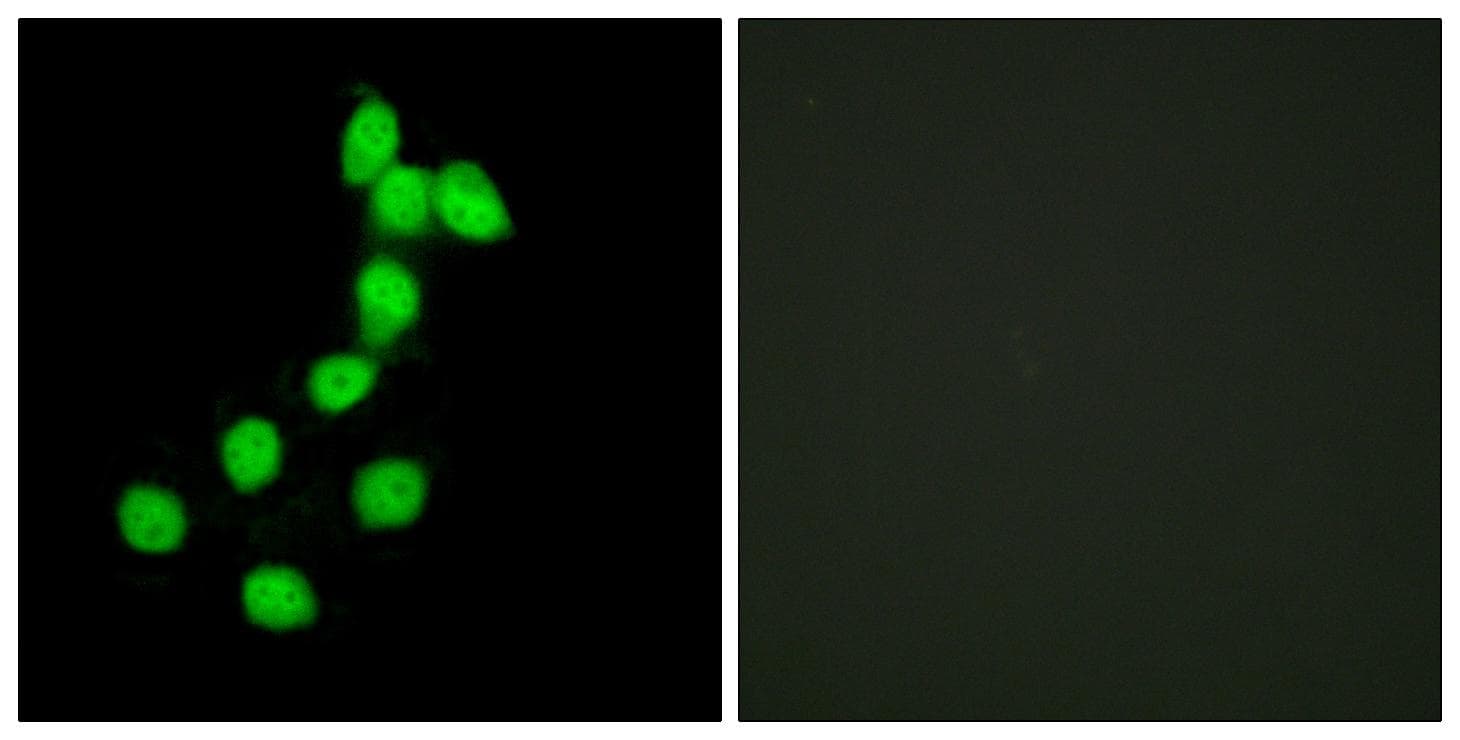 DYRK / DYRK1A Antibody
