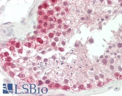 IHC-plus™ STAMBP / AMSH Antibody