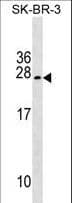 Polyclonal Rabbit anti-Human TUSC5 Antibody (aa78-104, WB)