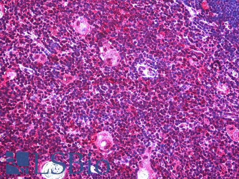 IHC-plus™ Polyclonal Rabbit anti-Human IGF2R / CD222 Antibody (aa2441-2490, IHC, IF)