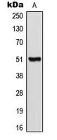 Polyclonal Rabbit anti-Human CRFR1 / CRHR1 Antibody (Internal, WB)